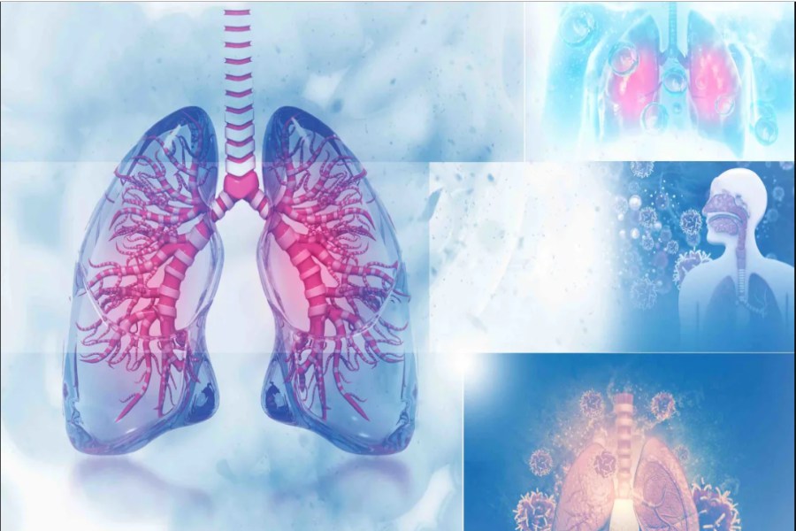 Lung Cancer Treatment 
