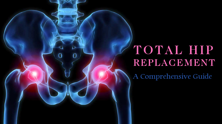 total-hip-replacement-a-comprehensive-guide