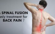 Is Spinal Fusion Only Treatment for Back Pain?