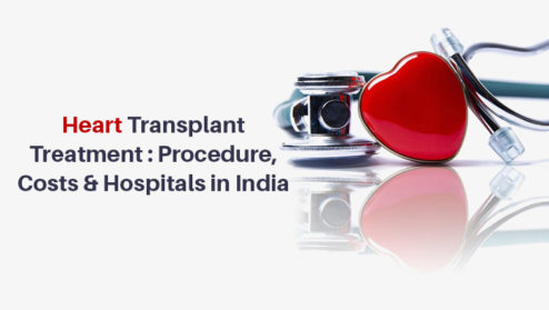 Heart-Transplant-Treatment